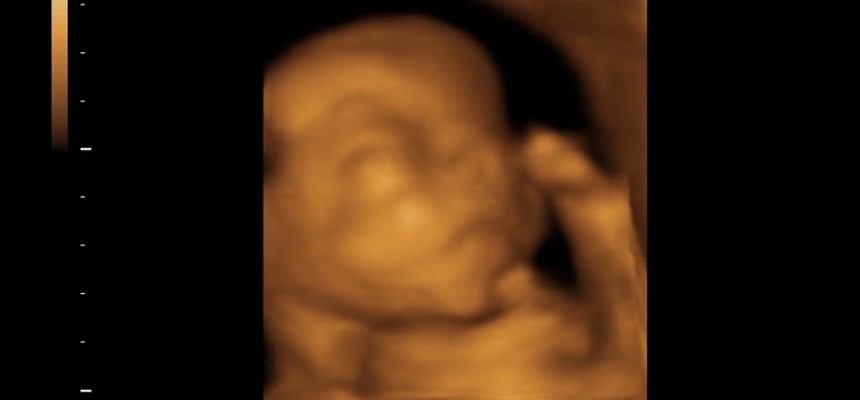 A Christmas present to the world… let the unborn babies live