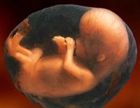 What Pro-Choicers Must Deny