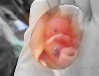 My Mother Chose Life