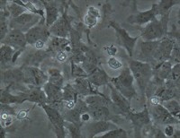 Is Stem Cell Research Ethical?